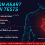 These common heart health tests could be routine or used to diagnose new conditions | HealthDiscovery.org