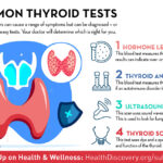 Learn more about the thyroid tests your doctor may prescribe with this infographic | HealthDiscovery.org
