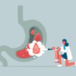 Female doctor extinguishing heartburn in the stomach illustration | Corporate Synergies